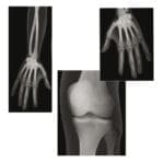 Imagini Roentgen - Radiografii ale corpului uman - Colectie pedagogica cu 18 planse in marime naturala