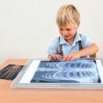 Imagini Roentgen - Radiografii ale corpului uman - Colectie pedagogica cu 18 planse in marime naturala