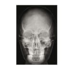 Imagini Roentgen - Radiografii ale corpului uman - Colectie pedagogica cu 18 planse in marime naturala